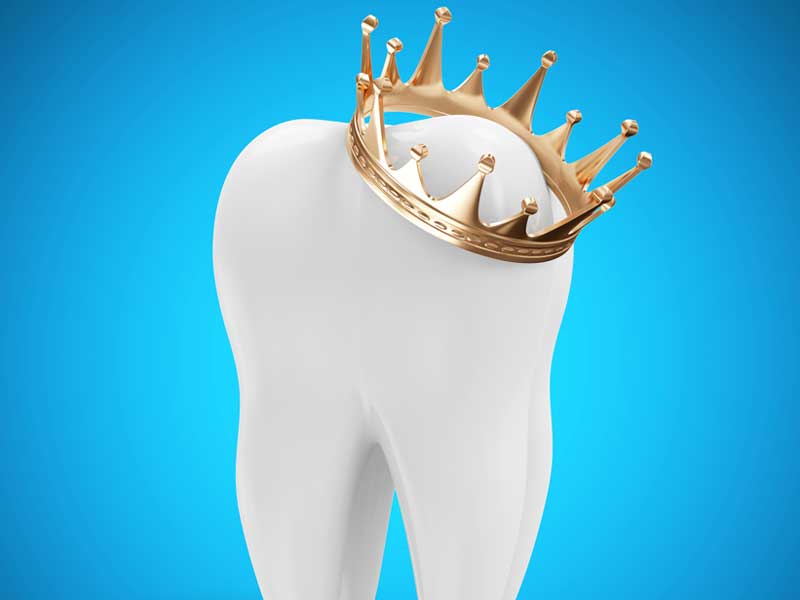 Dummy Tooth with Crown